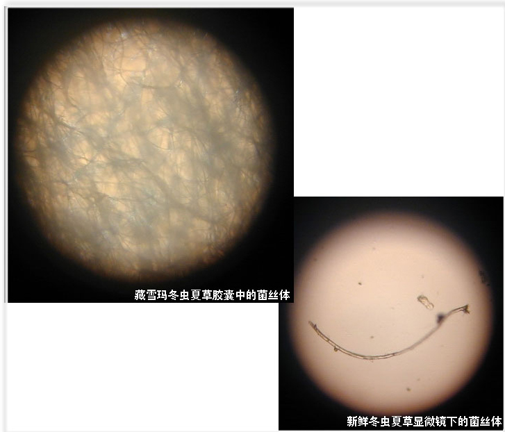 藏雪玛牌冬虫夏草胶囊在显微镜下的菌丝体